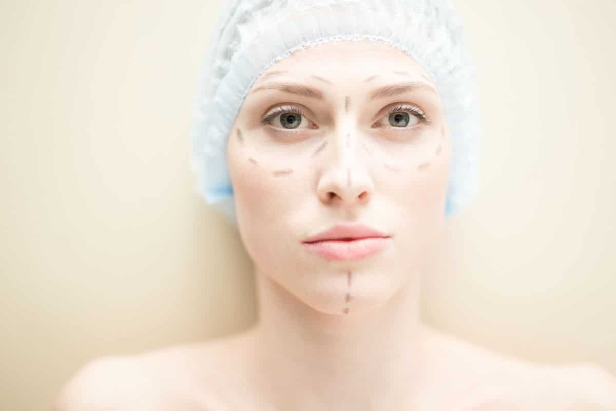 lipoaspiration visage